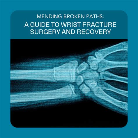 cnc machine wrist fracture|wrist fracture surgery recovery.